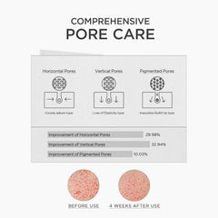 SKIN1004 Niacinamide 10% Boosting Shot Ampoule, Niacinamide Spicule Serum for Face, Facial Ampoule with Tranexamic Acid, Pore Minimizer for Face, Madagascar Centella, Korean Skin Care, 1.01fl.oz/ 30ml