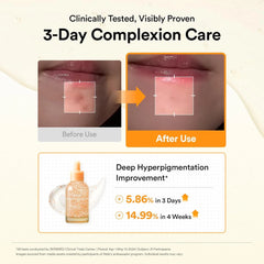 Abib Glutathiosome Dark Spot Serum Vita drop 1.69 fl.oz., Korean Skincare, Dark Spot, Hyperpigmentation Treatment, Lightweight, Hydrating Serum for Sensitive, Uneven Skin