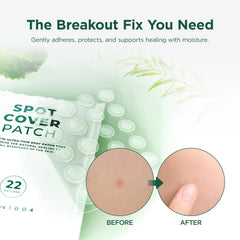 SKIN1004 Tea Trica Spot Cover Patch, Spot Patches for Blemish Prone Skin, Clear Hydrocolloid Pimple Patches for Face, Invisible Spot Stickers for Blemish Marks, Soothing Korean Skin Care, 22 Count
