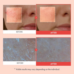 TOSOWOONG Mandelic Acid 2% Cream, AHA Exfoliator for Dark Spots, Freckles
