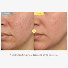 TOSOWOONG Honey Glow 65% Propolis Serum for Soothing & Uneven Tone, Barrier