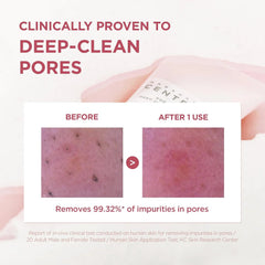 SKIN1004 [Hudson's Pick Poremizing Deep Cleansing Foam, Makeup Remover, Korean Face Cleanser with Himalayan Pink Salt & Centella for Facial Pore Cleansing, Korean Skin Care, 4.23 fl.oz, 125ml
